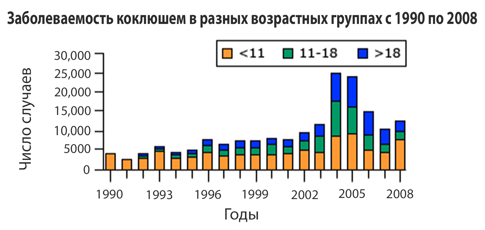 коклюш